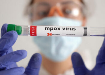 Virus Mpox : le Royaume-Uni enregistre ses premières transmissions locales hors d’Afrique.